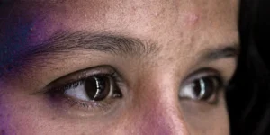 بهترین کرم برای سیاهی دور چشم