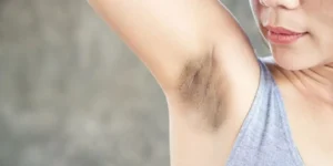 درمان تیرگی کشاله ران